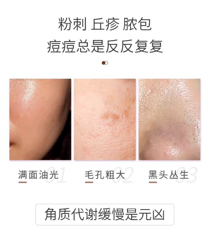Voolga 乳酸控油收敛面膜